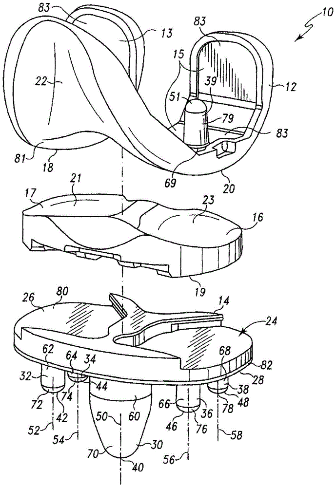 Prostheses with surfaces with different textures