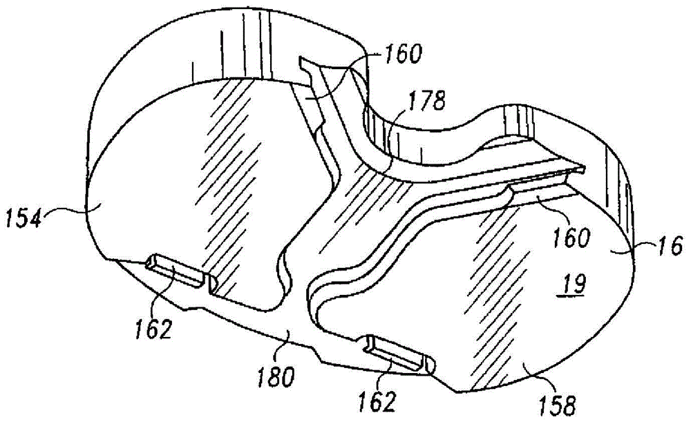 Prostheses with surfaces with different textures