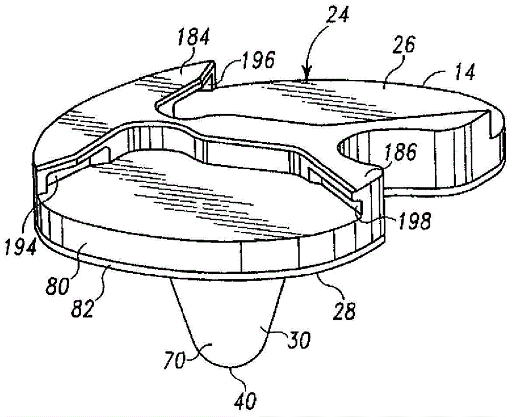 Prostheses with surfaces with different textures