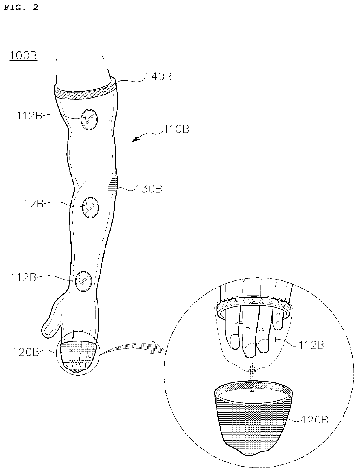 Compression stocking for hemiplegia patient