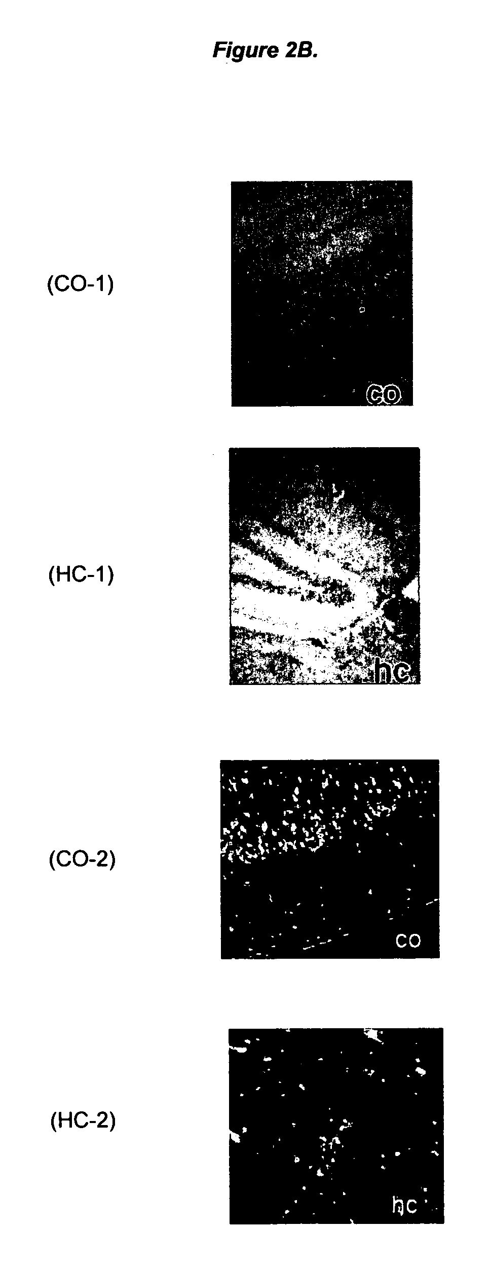 Ligands for aggregated tau molecules