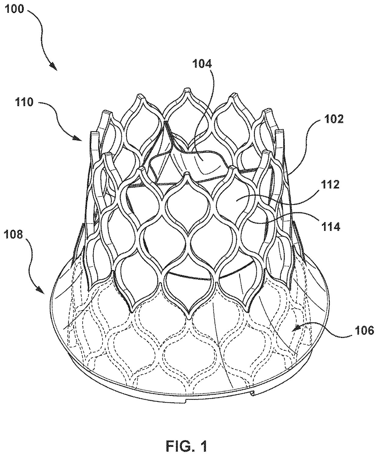 Prosthesis with Anti-paravalvular leakage component including a one-way valve