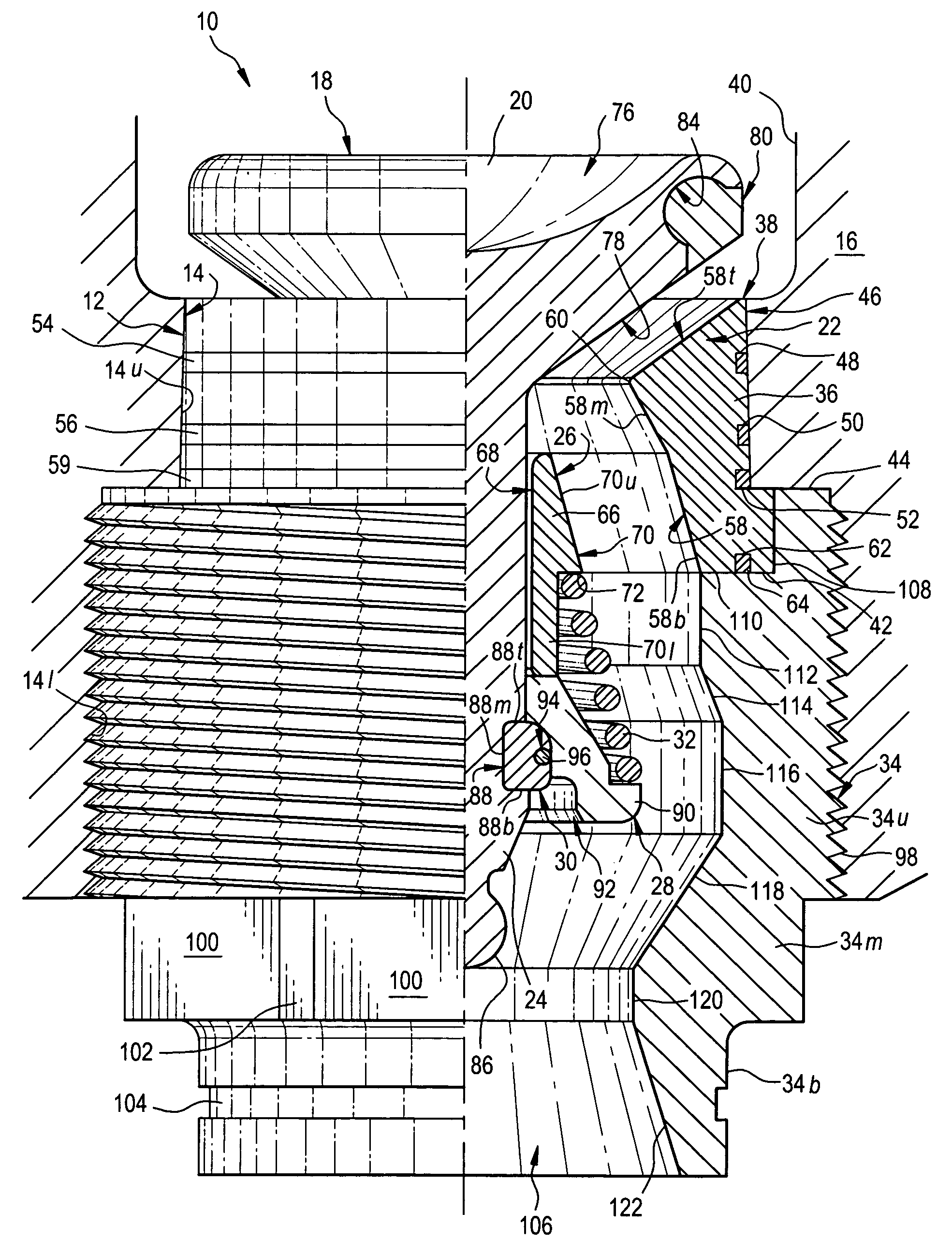 Suction valve