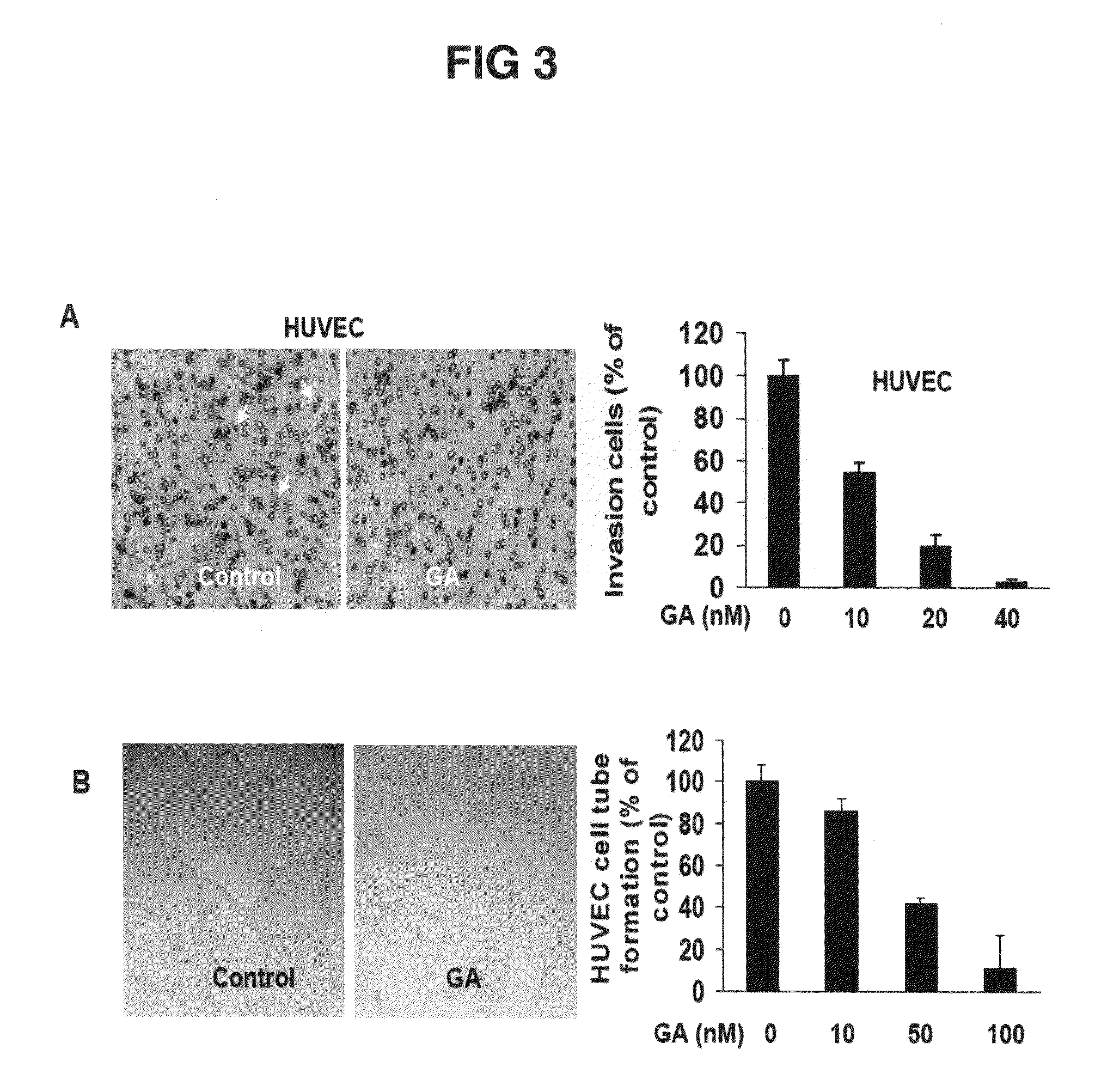 Methods and Compositions for the Treatment of Angiogenesis and Macular Degeneration