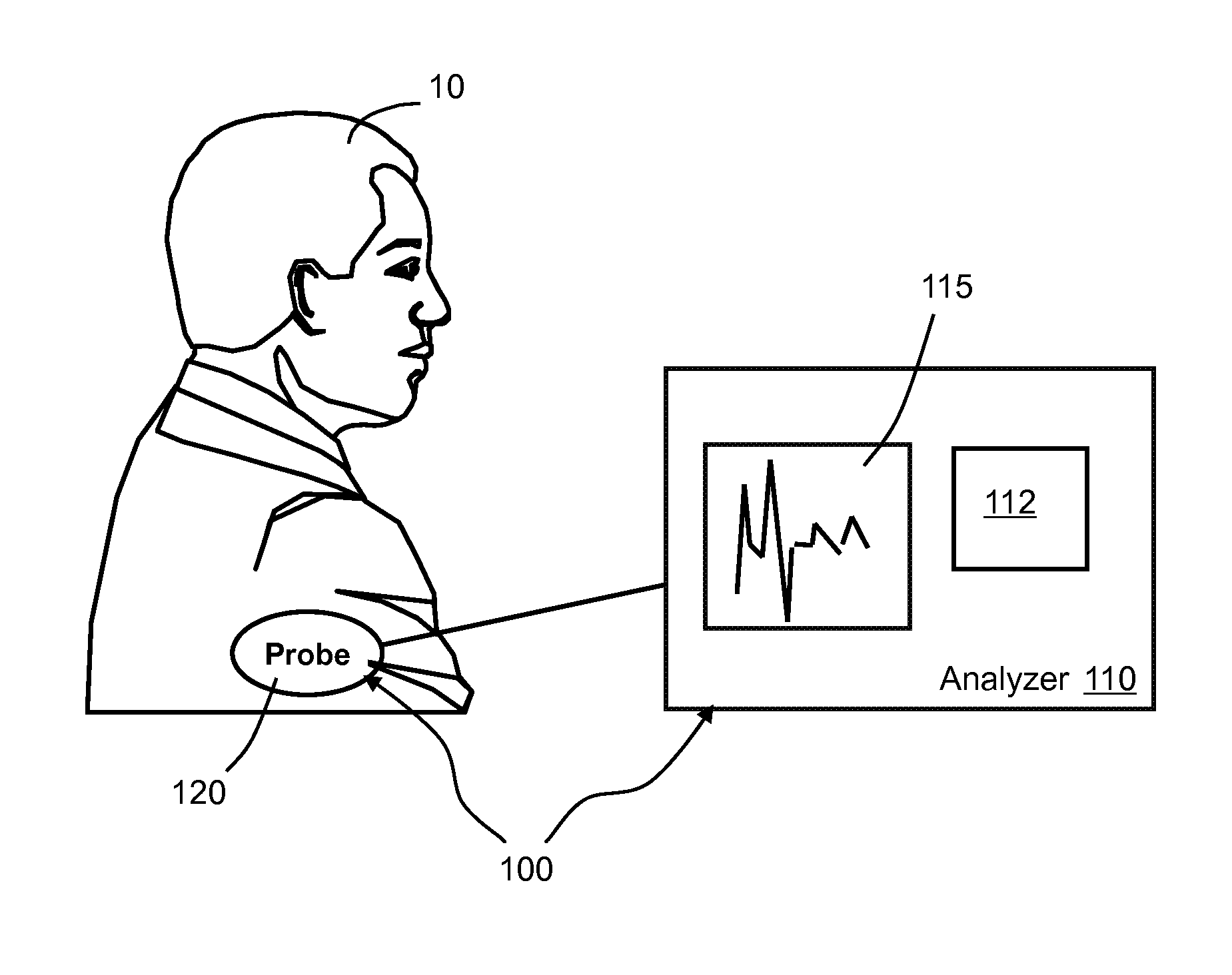 System and method for improved complex fractionated electrogram ablation