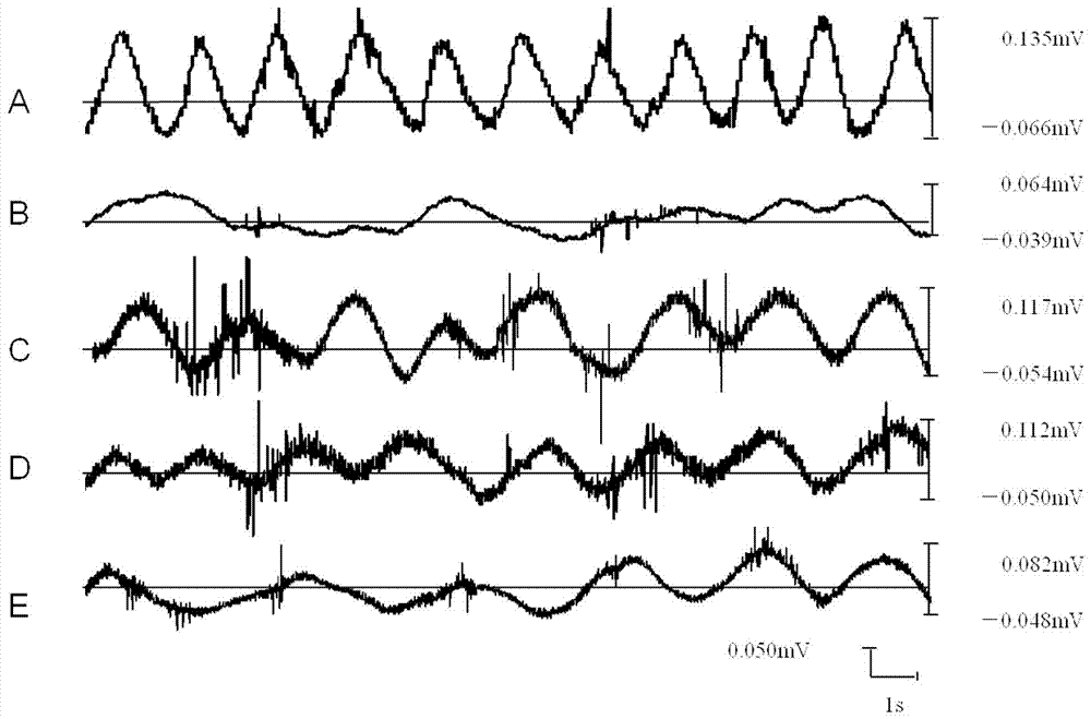 A traditional Chinese medicine preparation for assisting acupuncture in treating diabetic gastroparesis and its preparation method and application