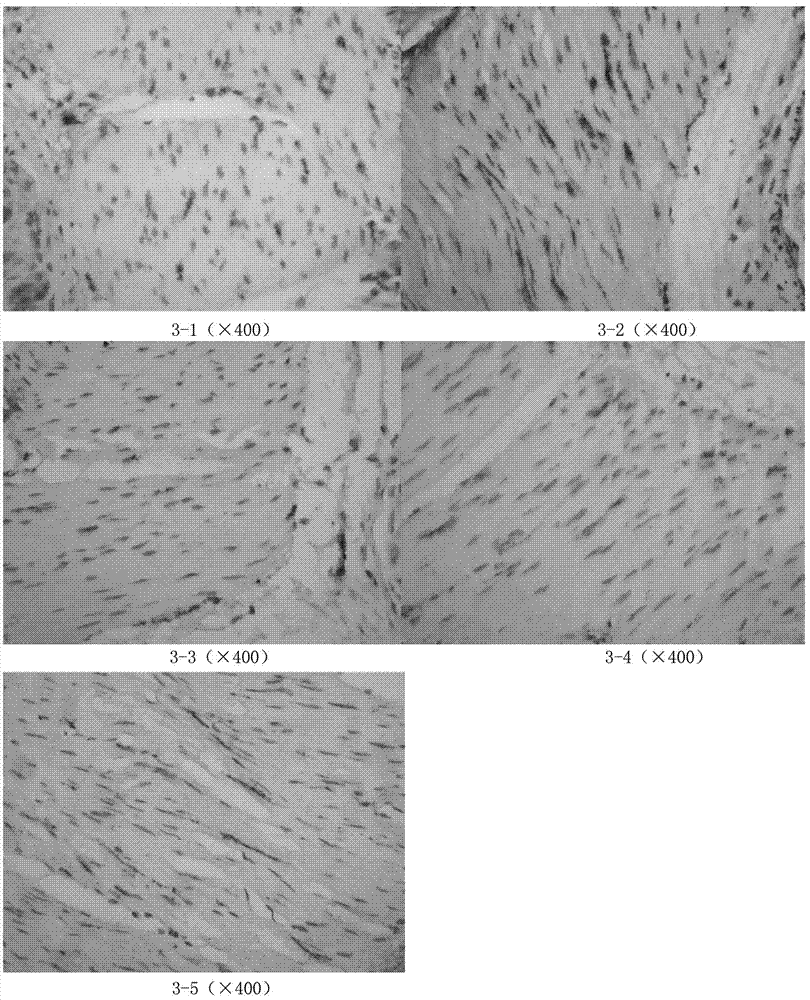 A traditional Chinese medicine preparation for assisting acupuncture in treating diabetic gastroparesis and its preparation method and application