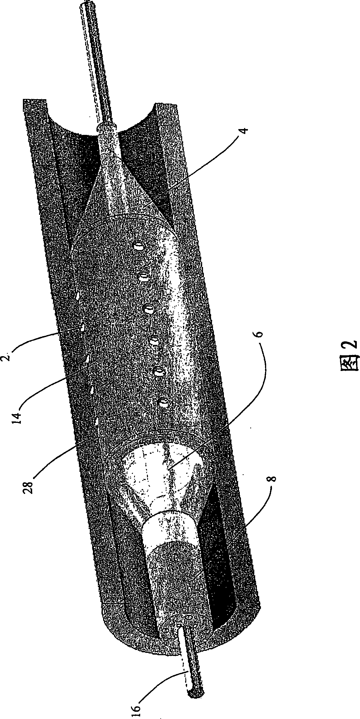 Minimally invasive intravascular treatment device