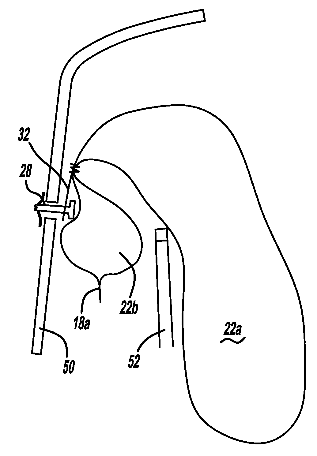 Side curtain airbag