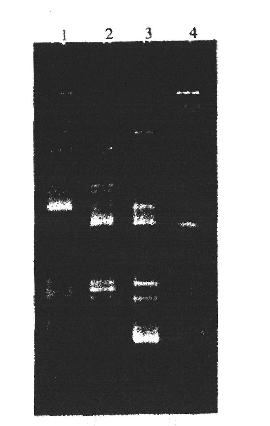 Analysis method for detecting diversity of soil microorganism