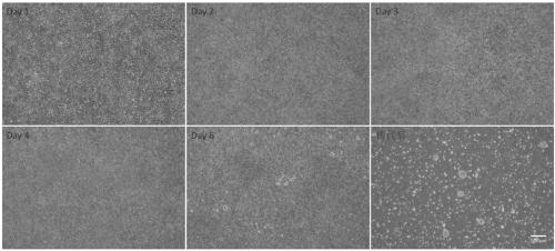 Neural stem cell induction differentiation medium and neural stem cell induction differentiation method