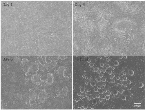 Neural stem cell induction differentiation medium and neural stem cell induction differentiation method