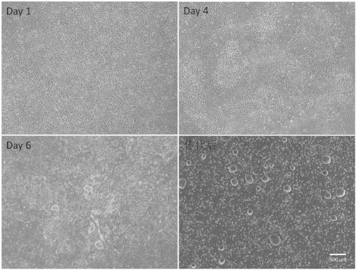 Neural stem cell induction differentiation medium and neural stem cell induction differentiation method