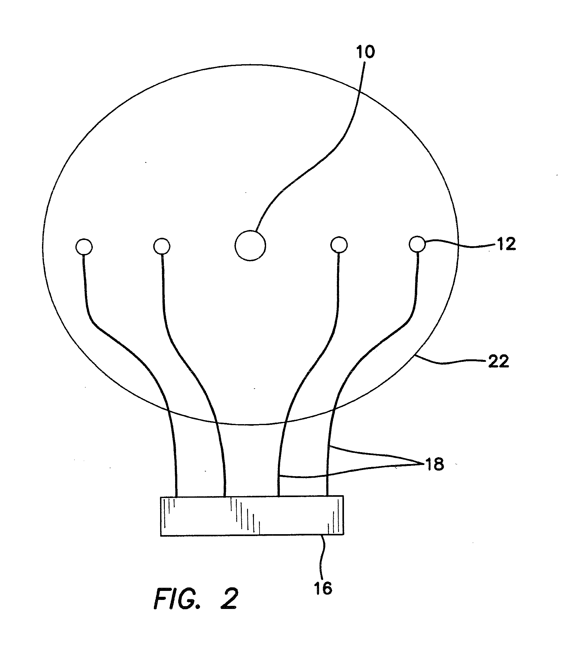 Chronically implantable hybrid cannula-microelectrode system for continuous monitoring electrophysiological signals during infusion of a chemical or pharmaceutical agent