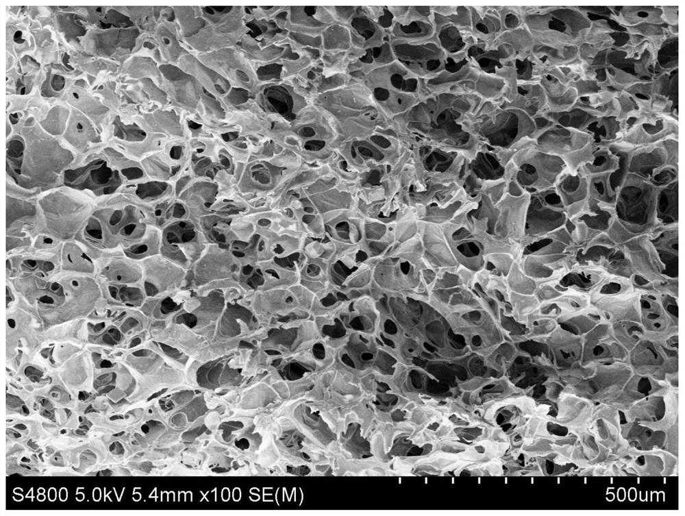 Spherical mesoporous calcium silicate/chitosan three-dimensional porous scaffold material, preparation method and application