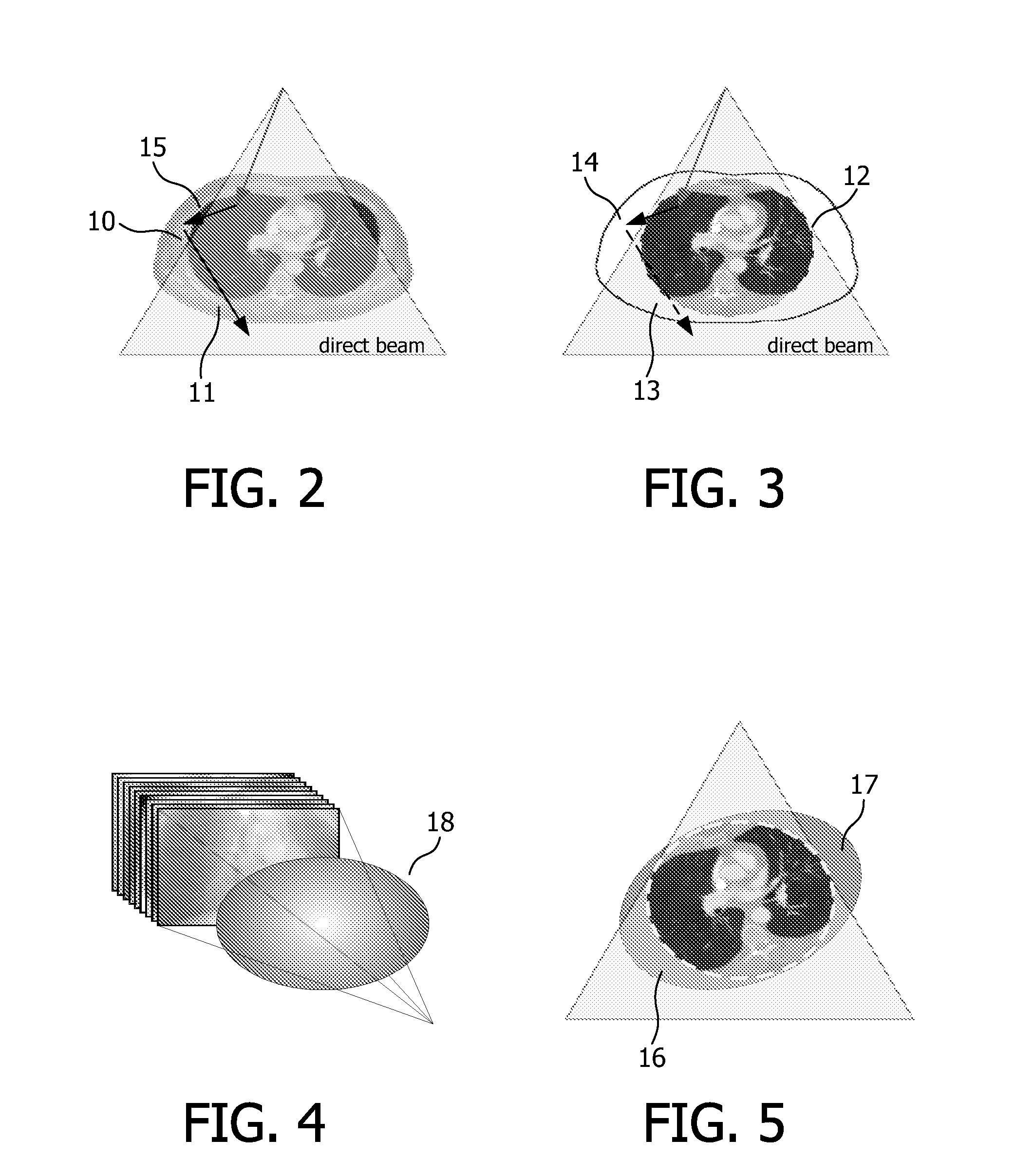 Method for eliminating scatter artefacts