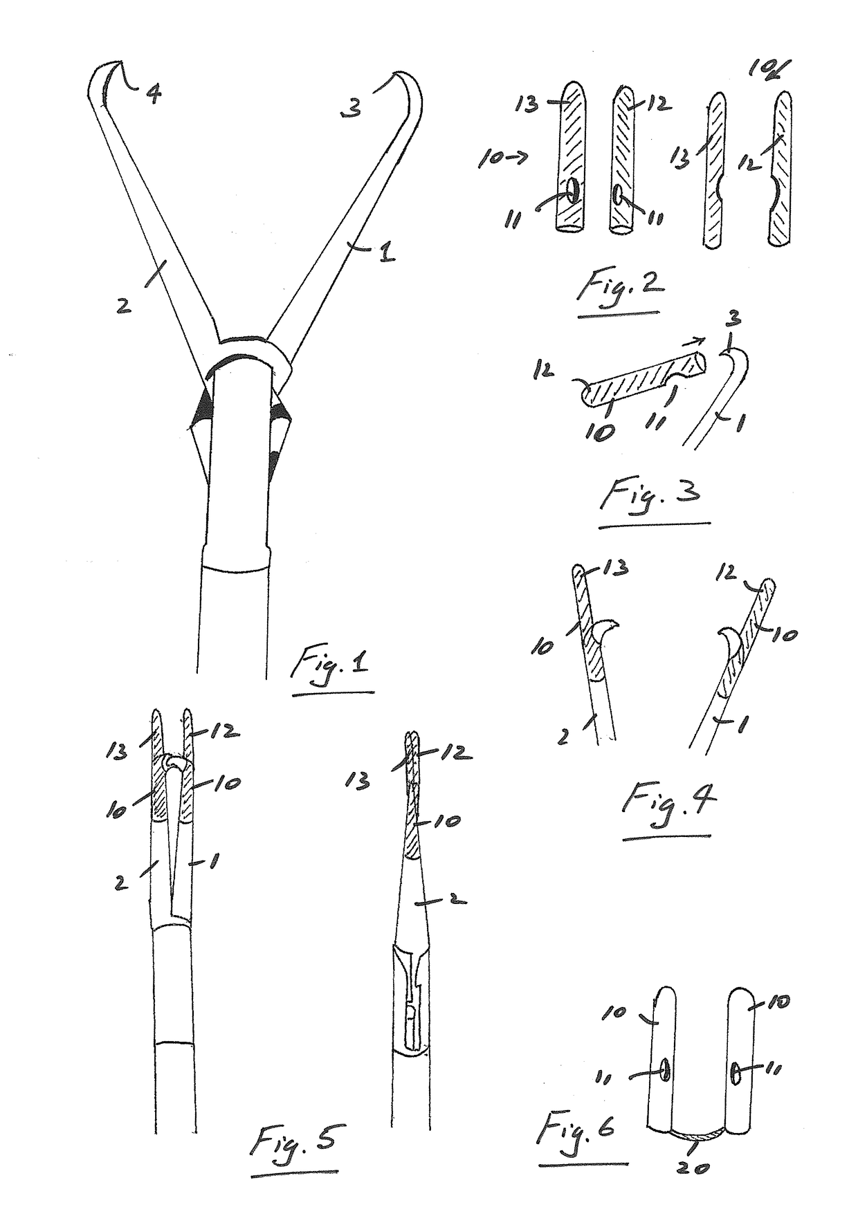 Tenaculum