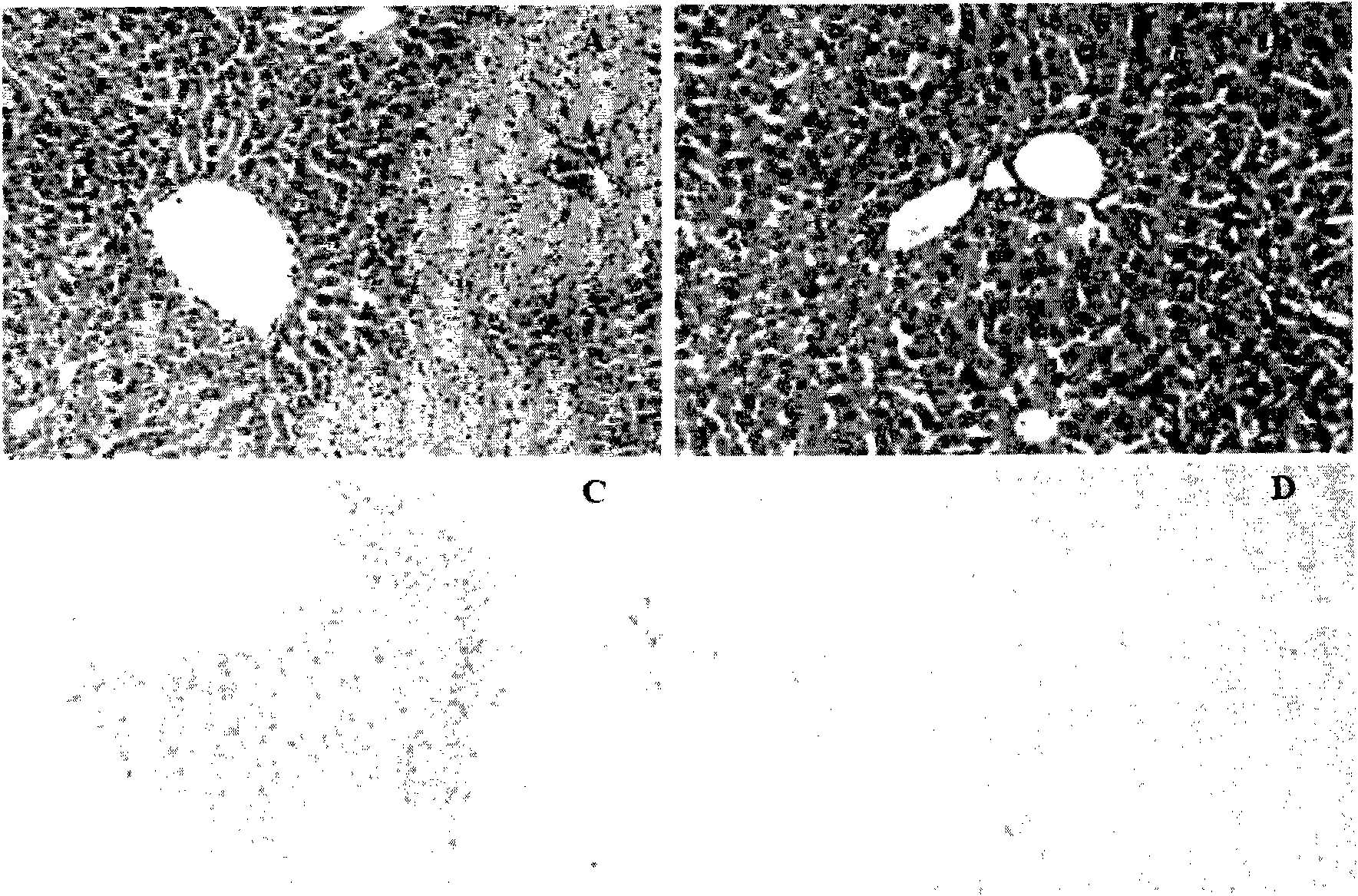 Liver damage relevant drug target and application thereof