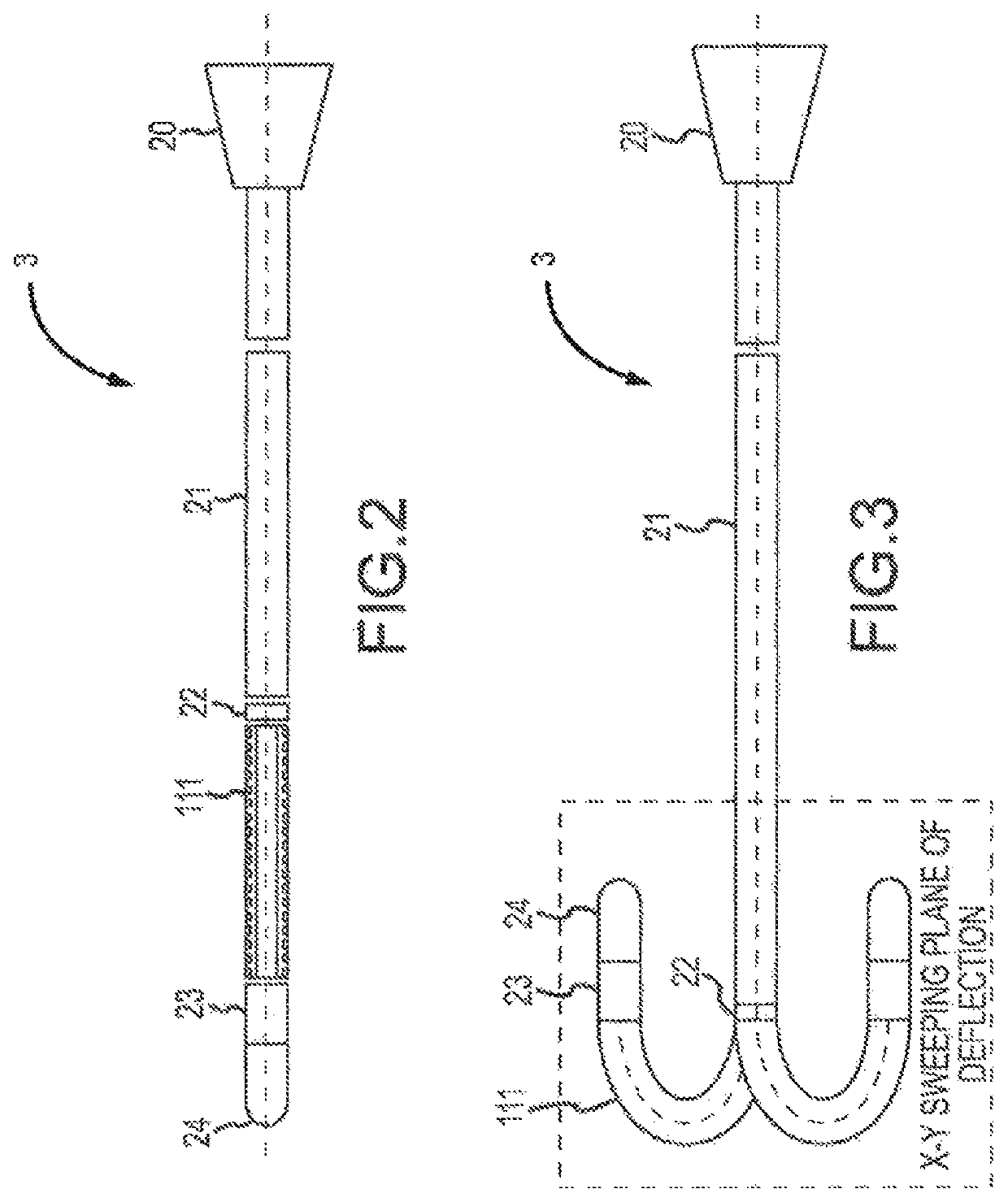 Deflectable catheter bodies with corrugated tubular structures