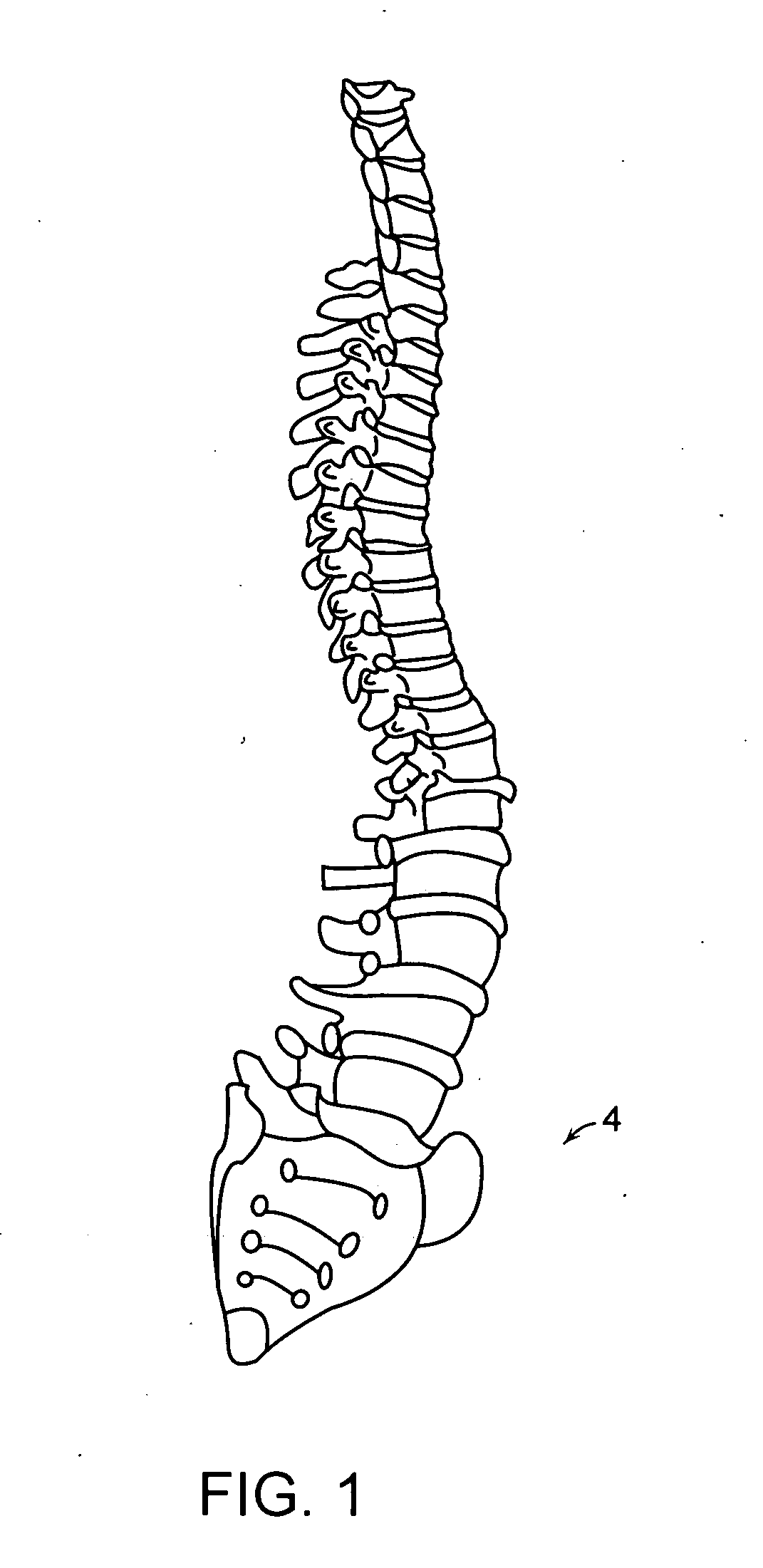 Method of deriving a quantitative measure of a degree of calcification of an aorta