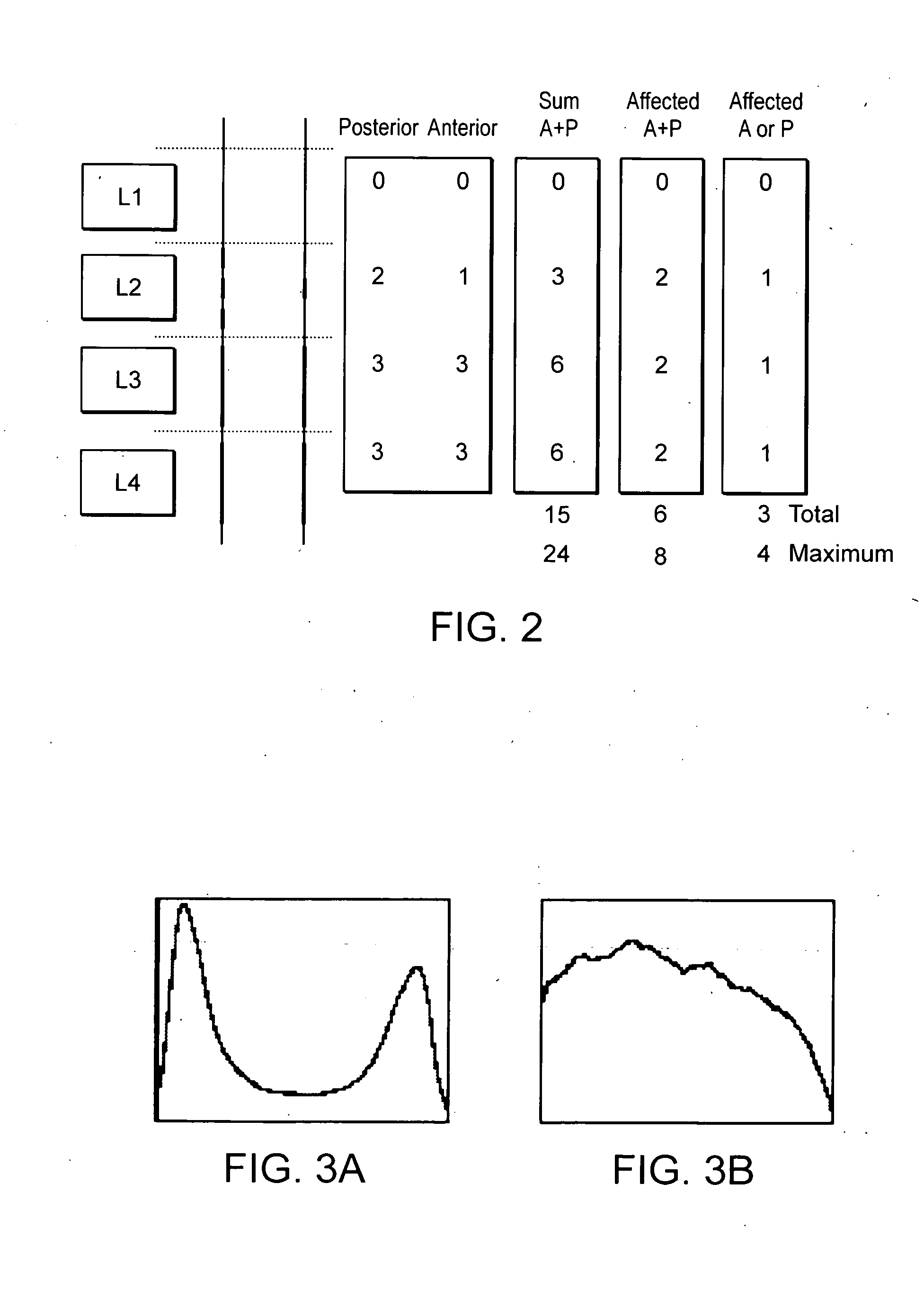 Method of deriving a quantitative measure of a degree of calcification of an aorta