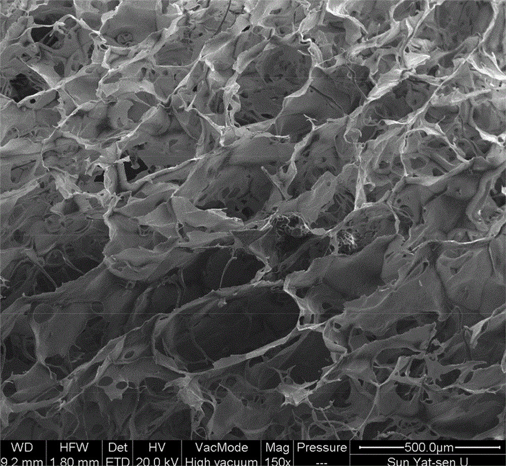 Acellular tissue matrix composite and preparation method thereof