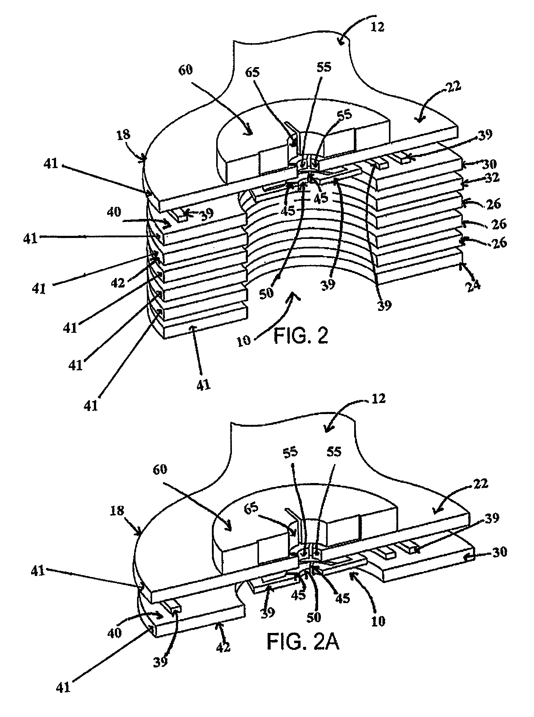 Radiolucent electrode assembly