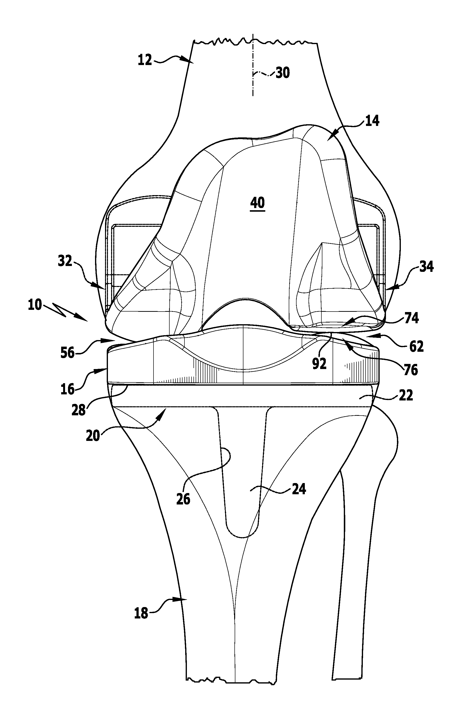 Knee joint endoprosthesis