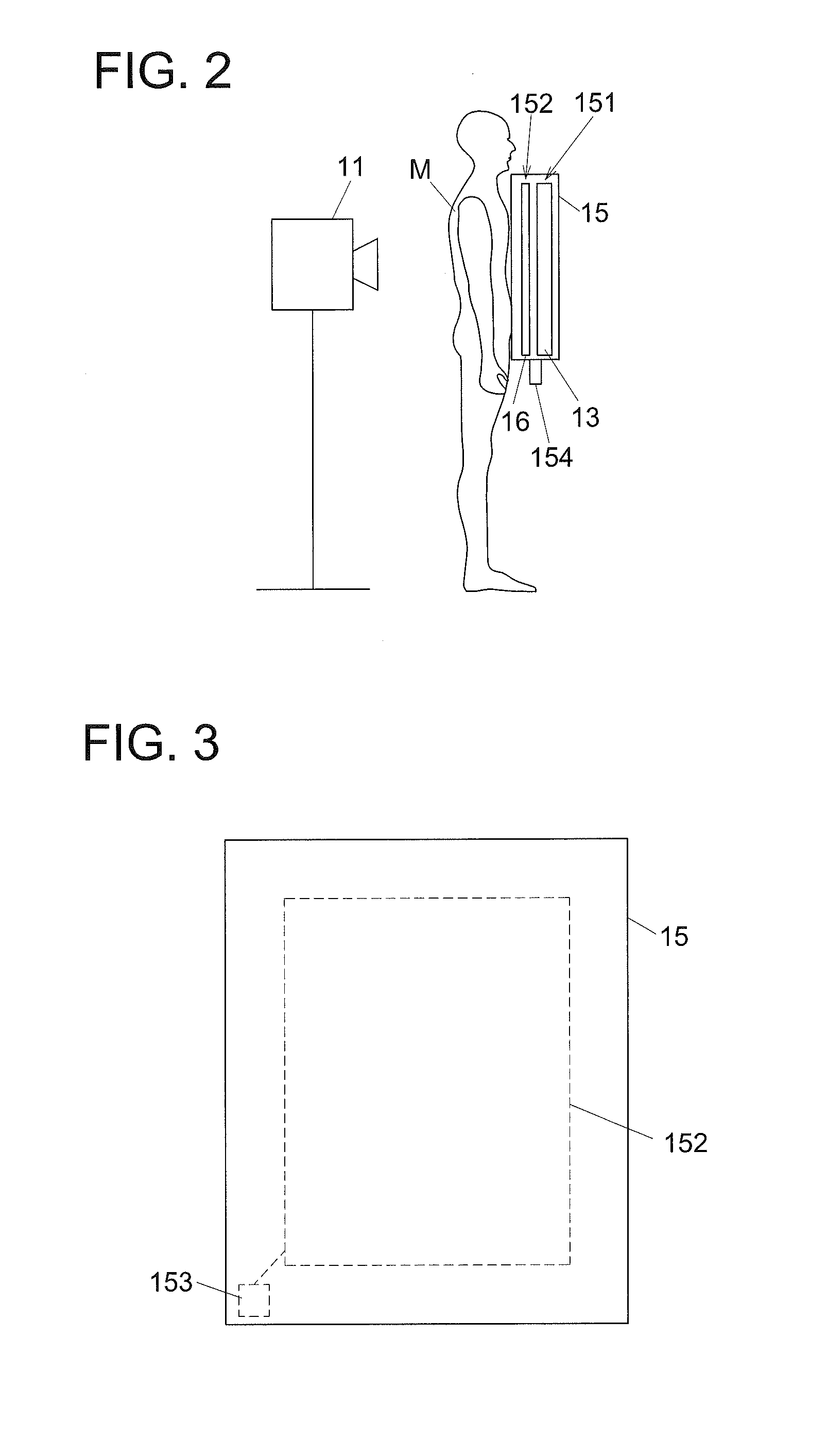 Chest diagnostic support information generation system