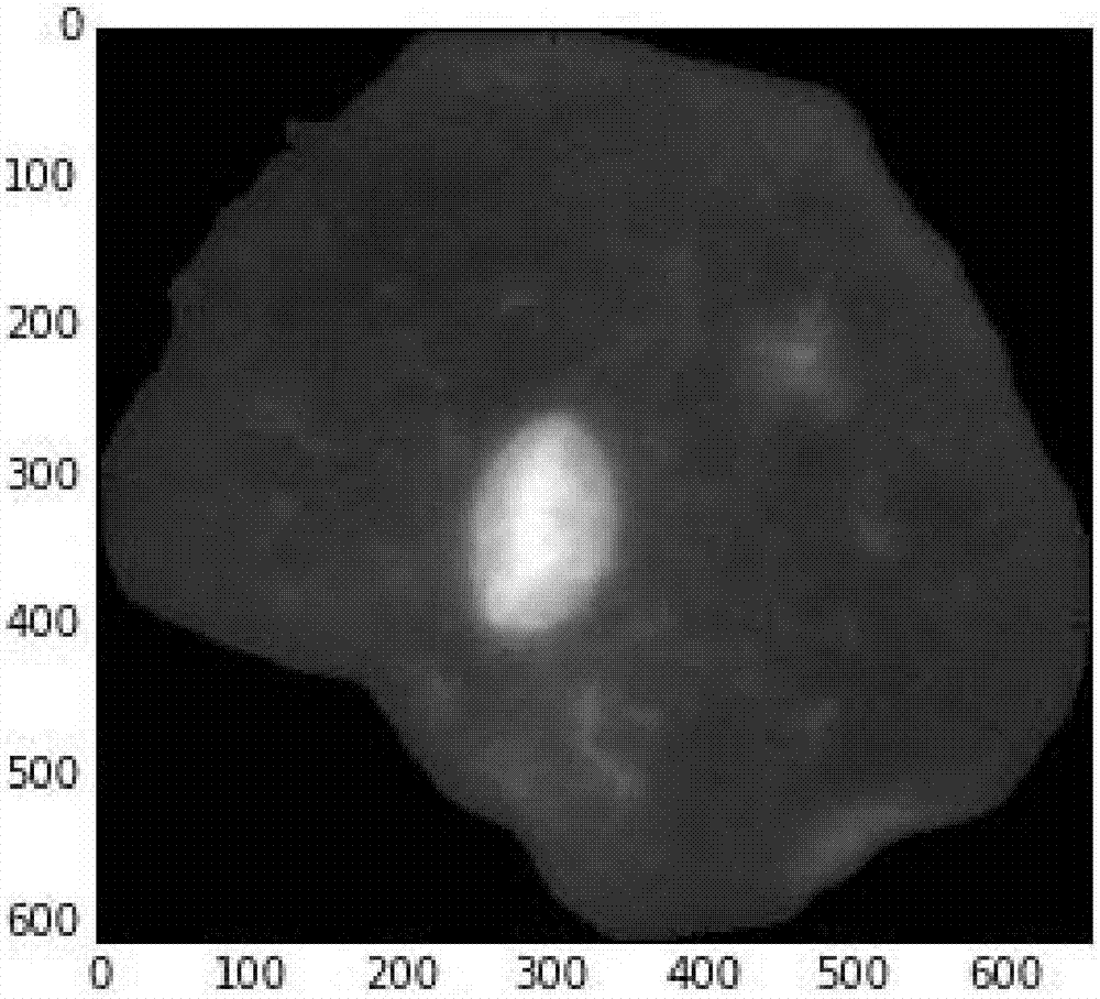 Cast-off cell one-step staining method, and dye combination and kit for cast-off cell one-step staining method