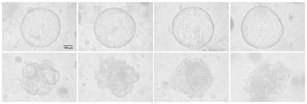 Mouse lung organ culture method