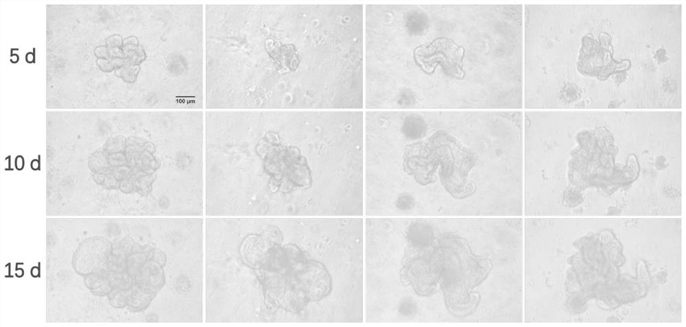 Mouse lung organ culture method