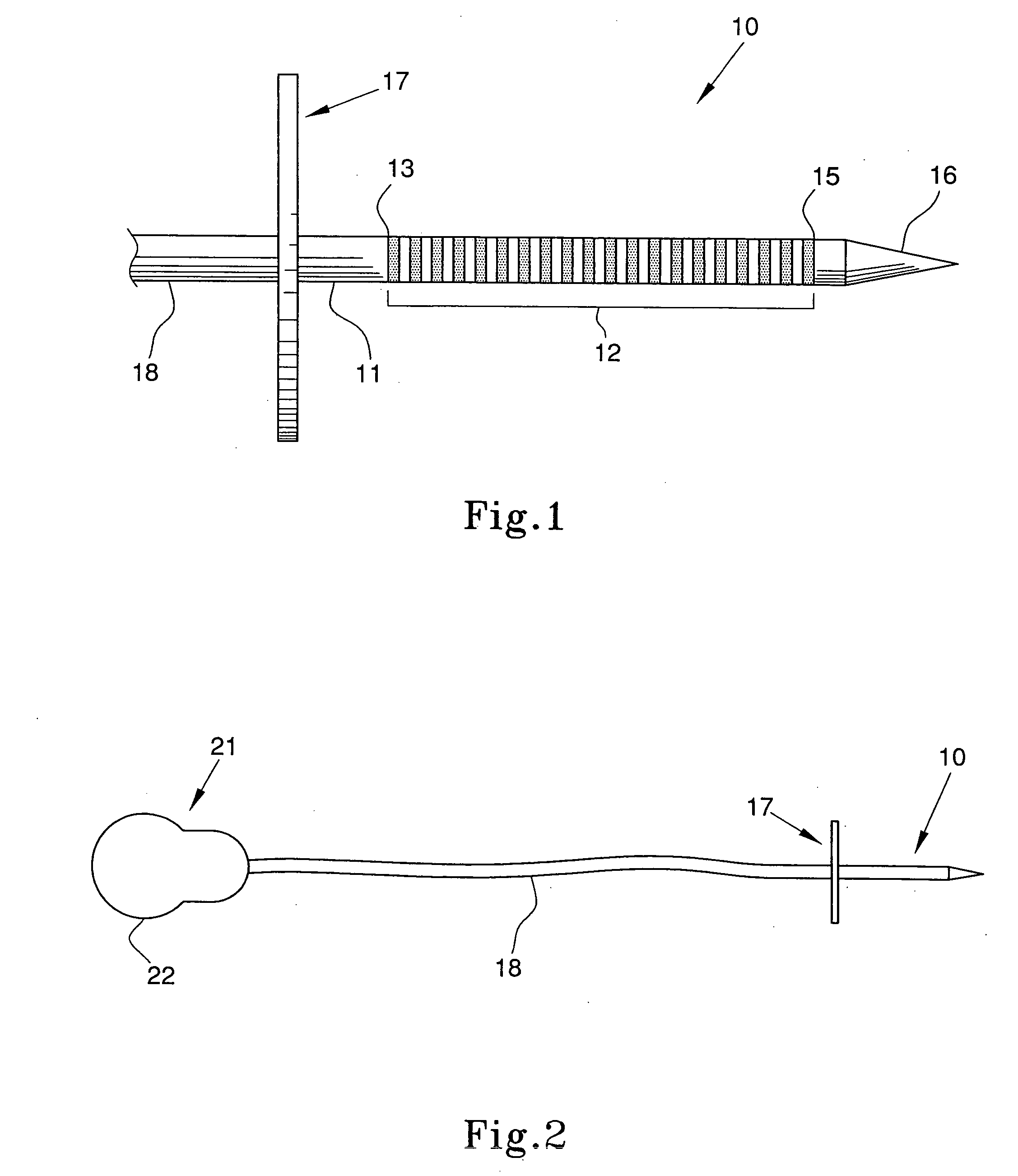 Auditory midbrain implant