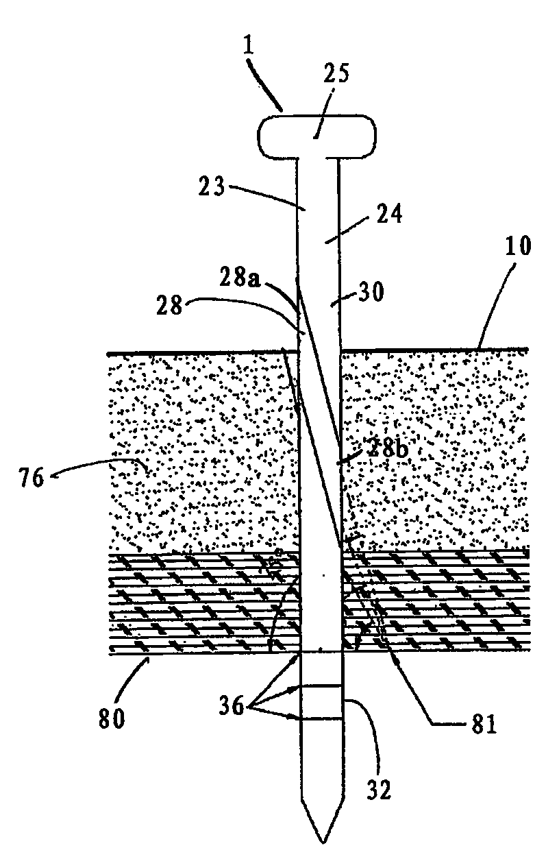 Apparatus and method of laparoscopic port site suture