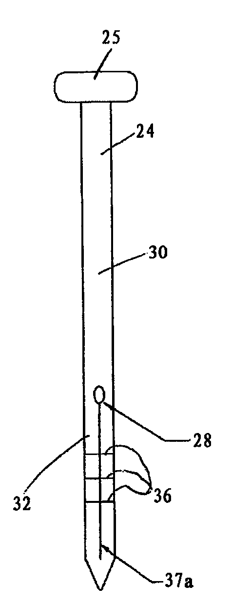 Apparatus and method of laparoscopic port site suture