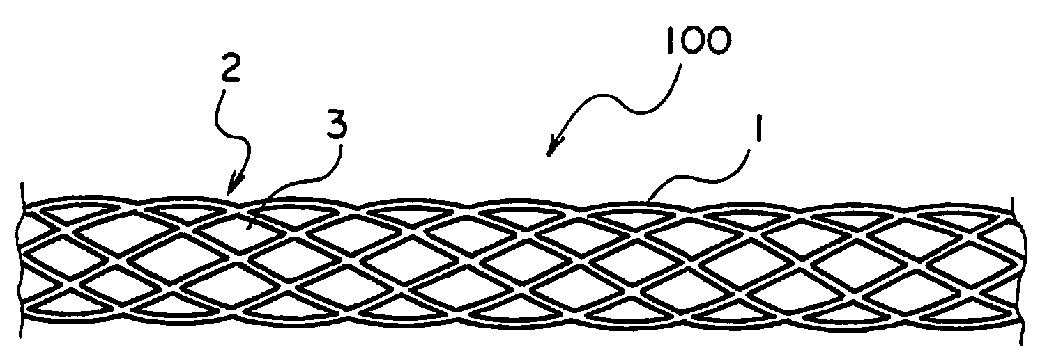 Balloon expandable superelastic stent