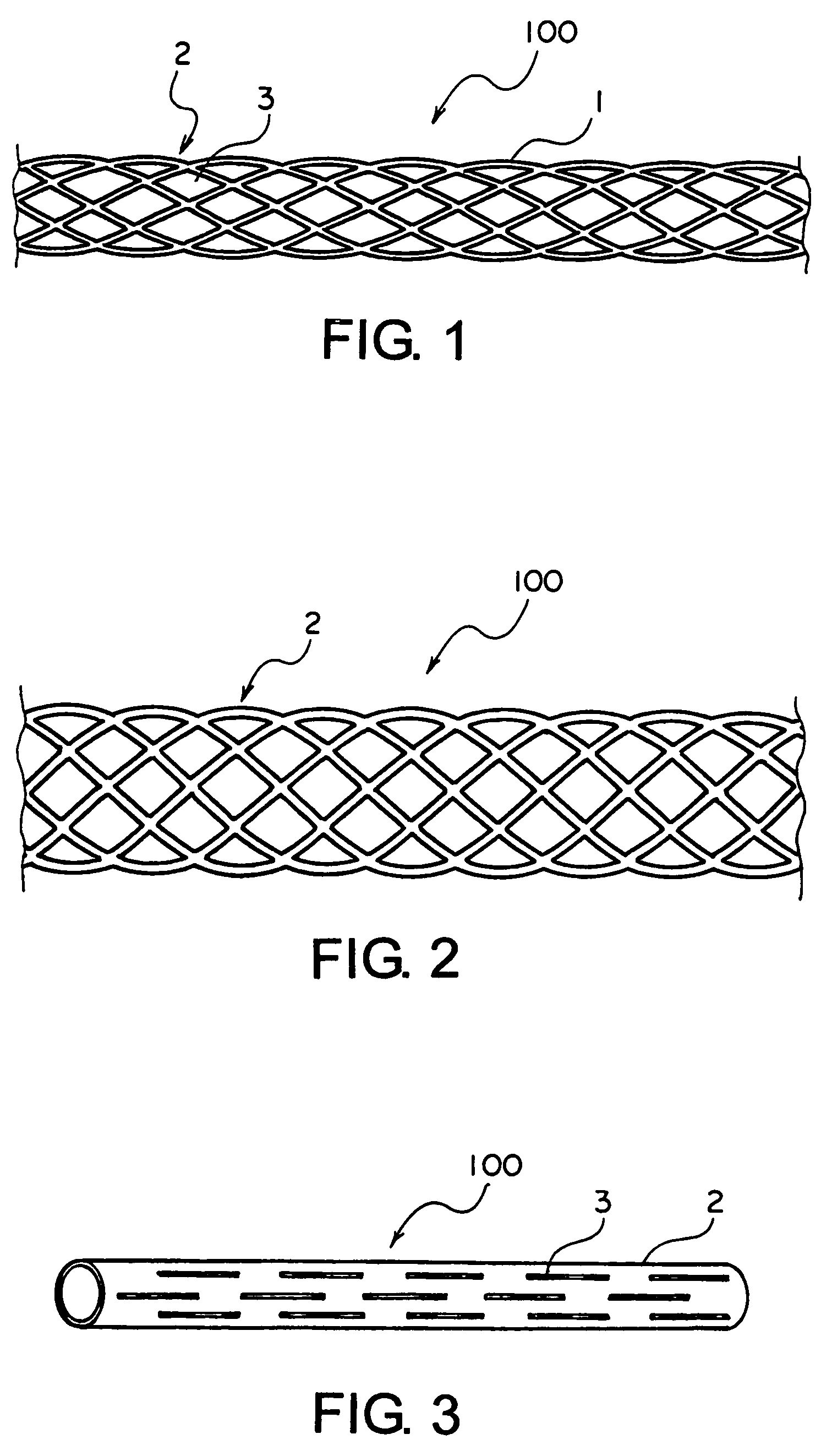 Balloon expandable superelastic stent