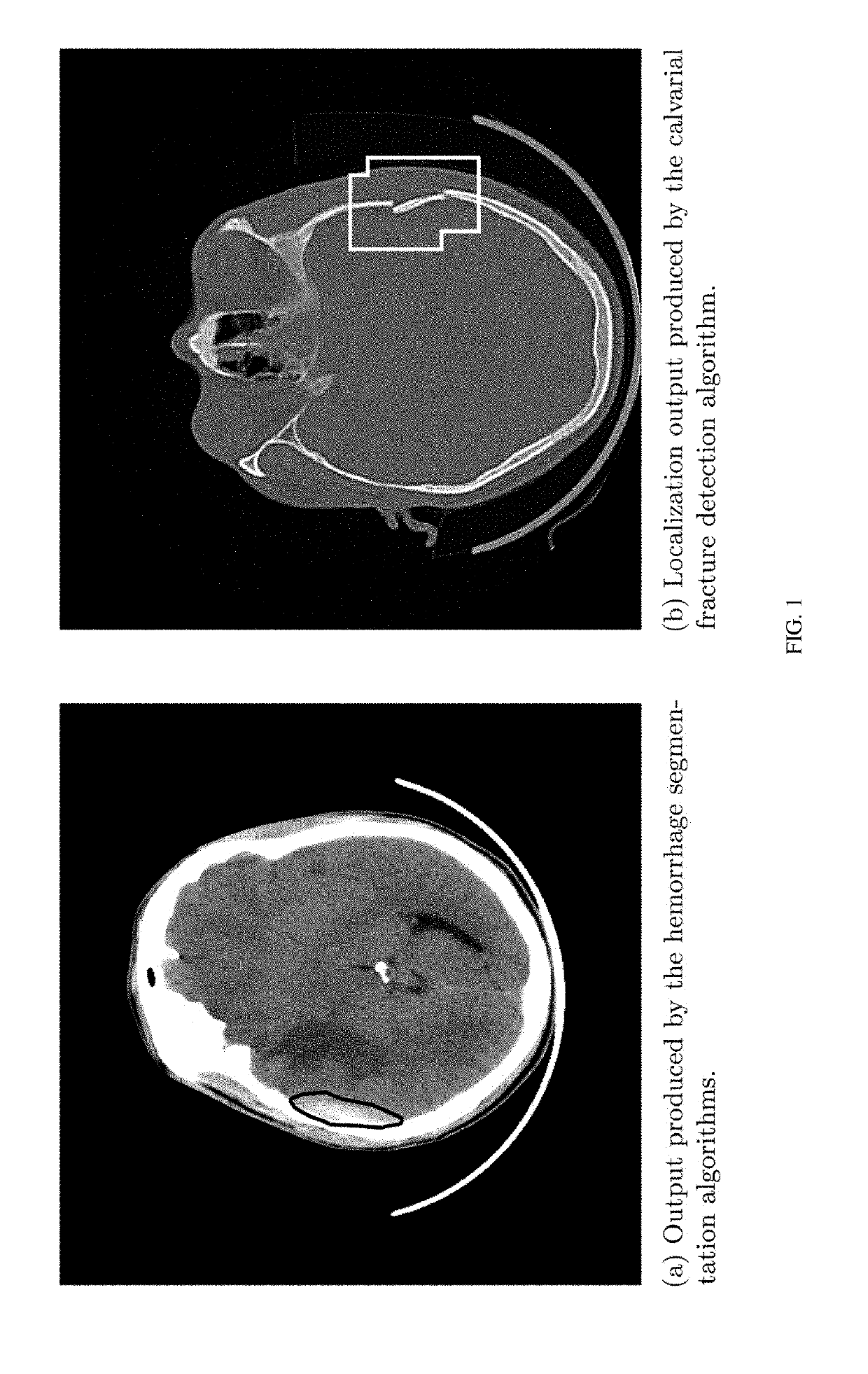 Application of deep learning for medical imaging evaluation