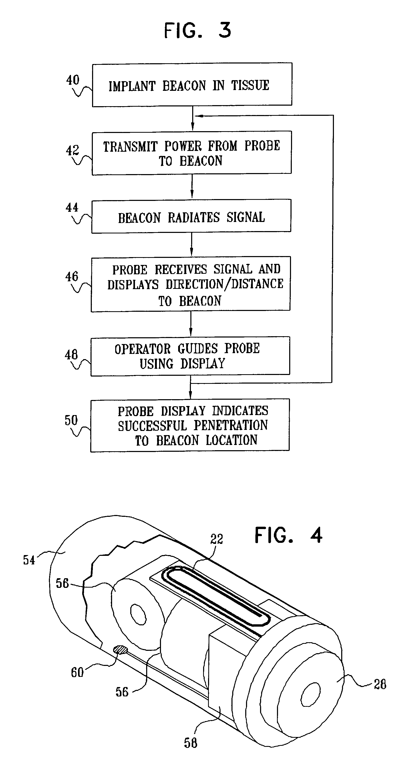 Guidance of invasive medical procedures using implantable tags