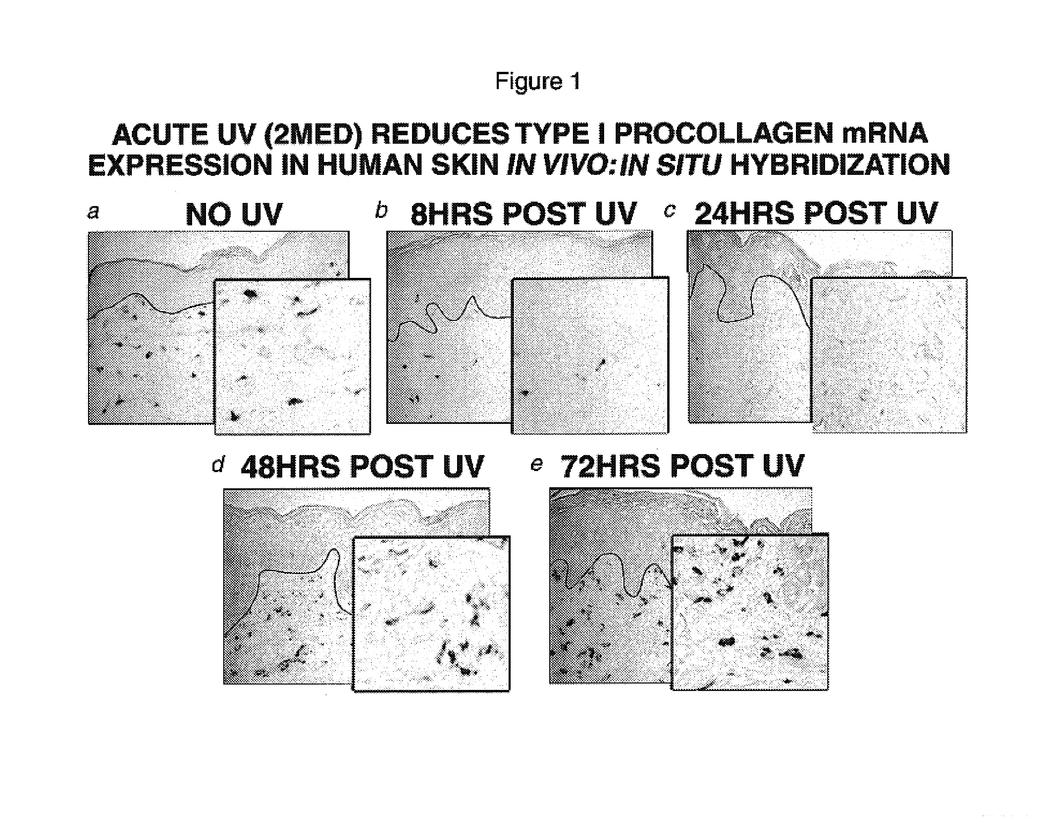 Compositions for reducing UV-induced inhibition of collagen biosynthesis in human skin