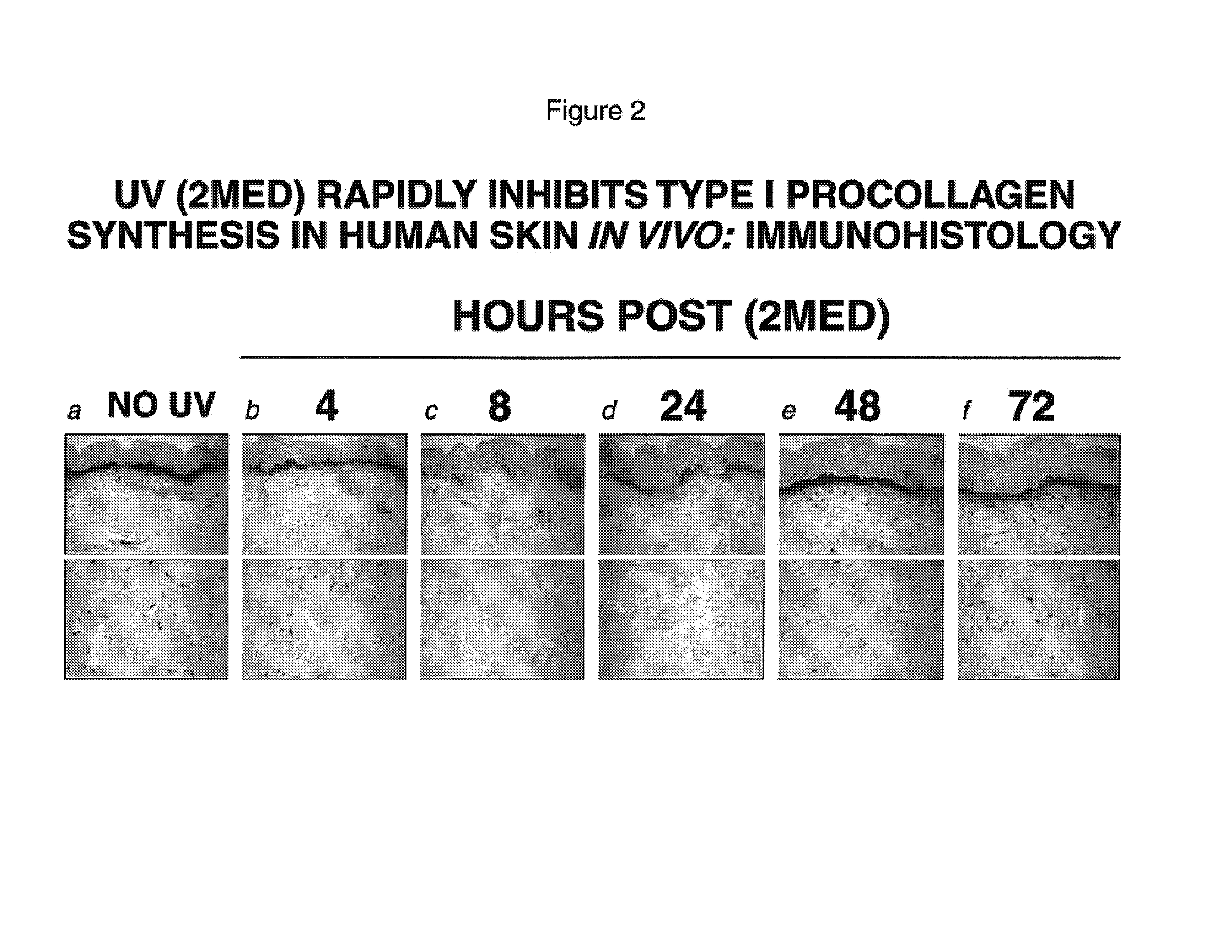 Compositions for reducing UV-induced inhibition of collagen biosynthesis in human skin