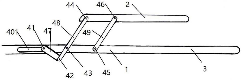 A Minimally Invasive Collagen Membrane Holder for Tissue-Engineered Cartilage Transplantation