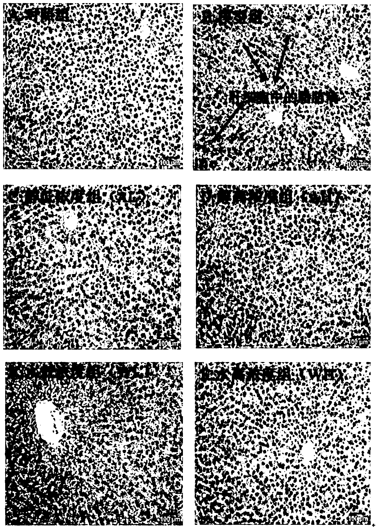 Application of Malus toringoides and/or Malus toringoides extract in preparation of drugs for preventing and treating nonalcoholic liver diseases and/or nonalcoholic liver injury