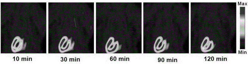 [&lt;18&gt;F]-fluoromethyl triphenylphosphine salt, preparation method and application thereof