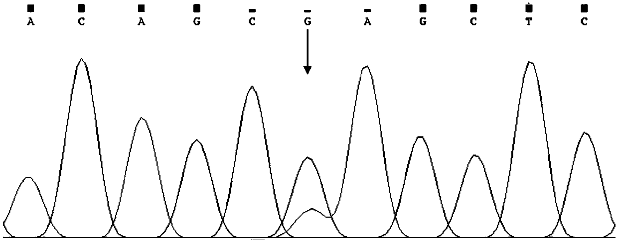 Kit for LVA (Large Vestibular Agueduct)/Pendred syndrome virulence gene SLC26a4 mutation detection