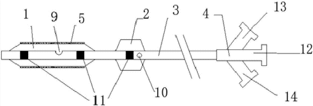 Double-balloon drug coating balloon dilatation catheter