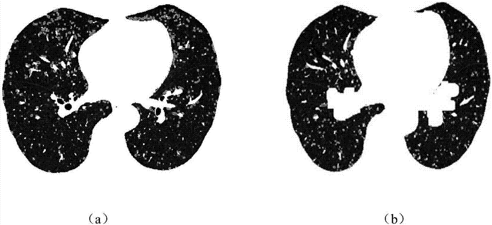 Method for extracting terminal bronchial tree from lung CT image