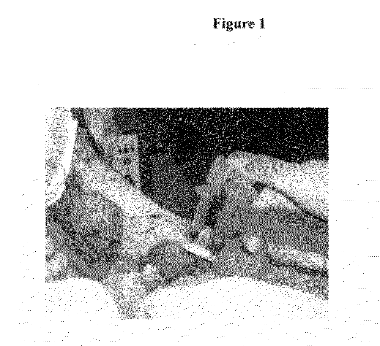 Methods and materials for treating burn injuries