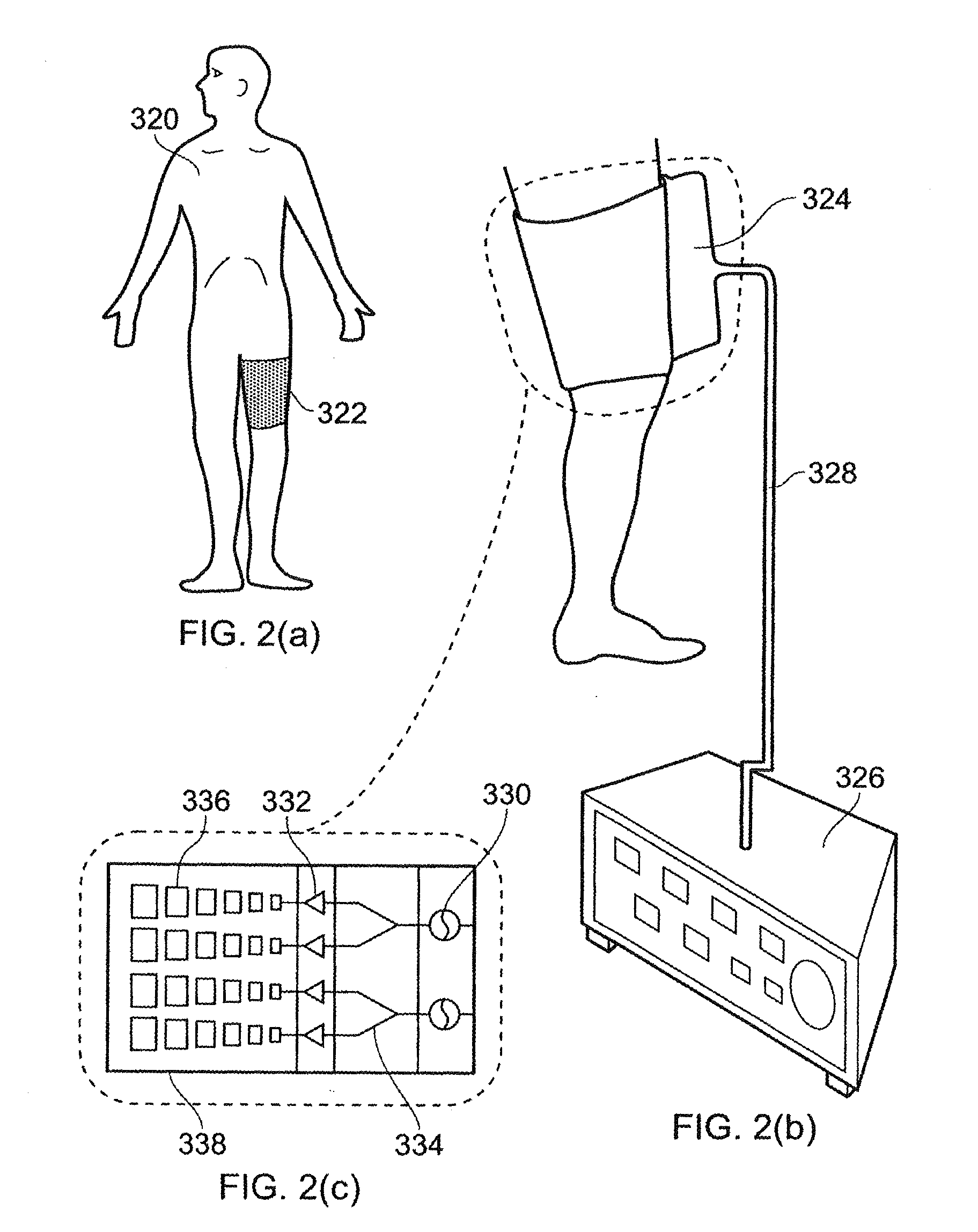 Microwave array applicator for hyperthermia