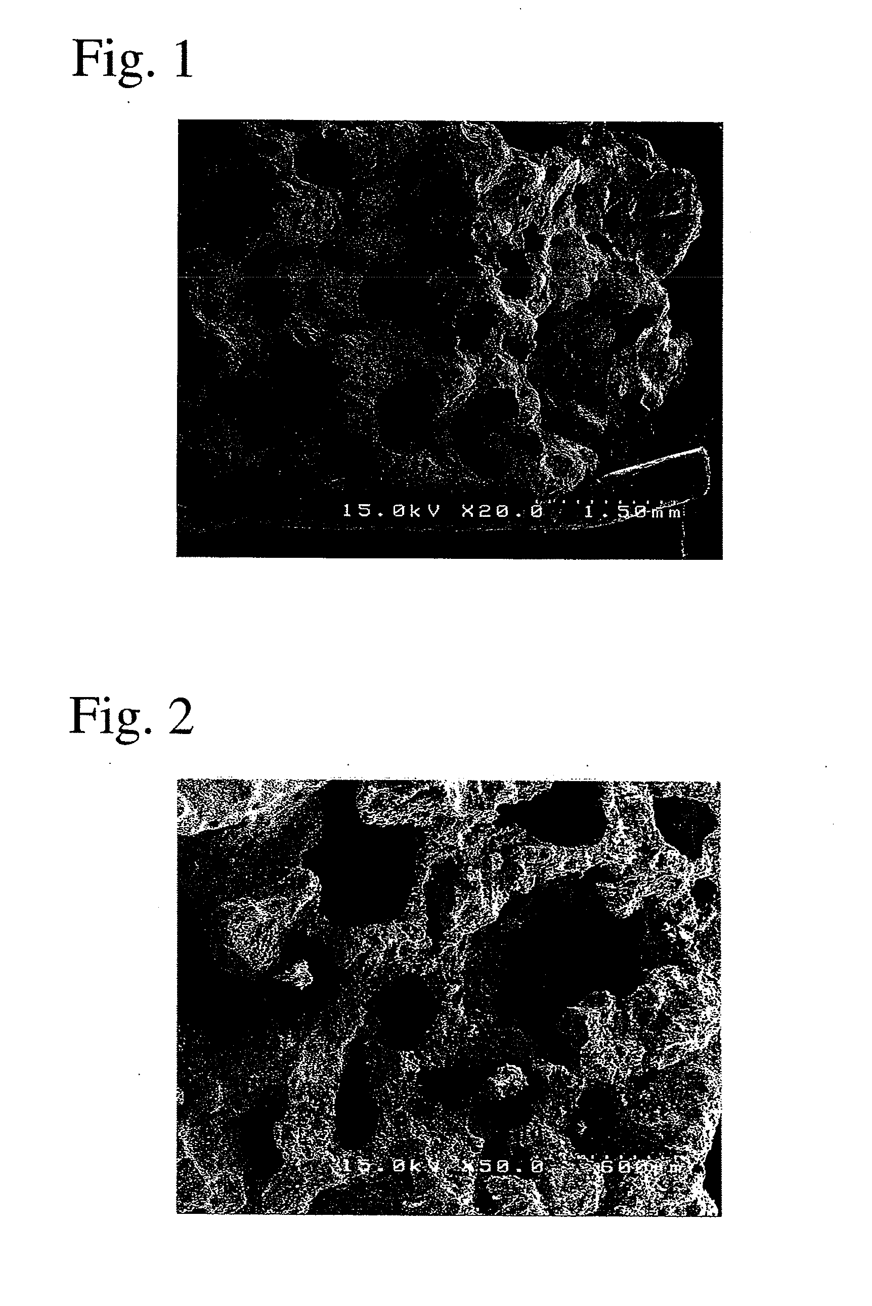 Calcium phosphate cement composition and its kit for bone prosthesis